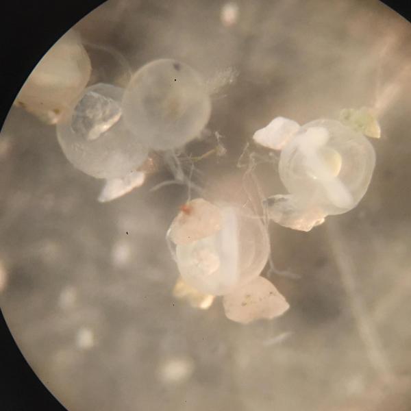 Four Pacific sand lance eggs under a microscope